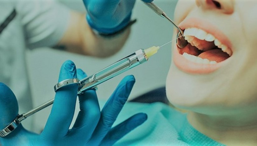 بنج الأسنان 