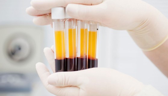 بلازما الدم