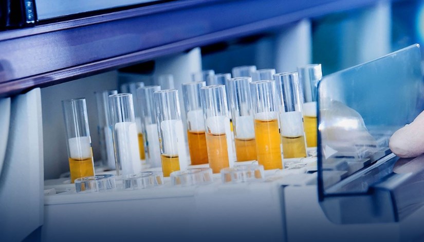 تصنيع مشتقات البلازم