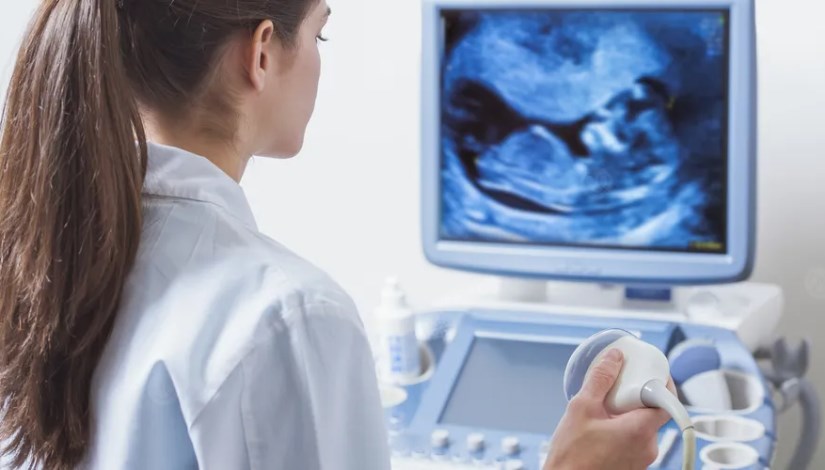 أجهزة مسح بالموجات فوق الصوتية