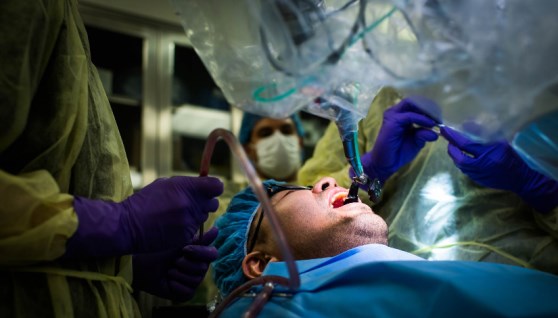 زراعة الأسنان