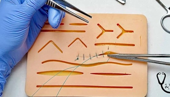  أشرطة الجراحة- أرشيفية