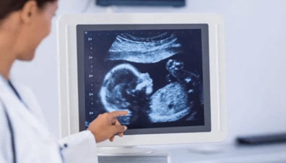 أجهزة مسح بالموجات فوق الصوتية