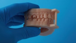 الطباعة ثلاثية الأبعاد للأسنان