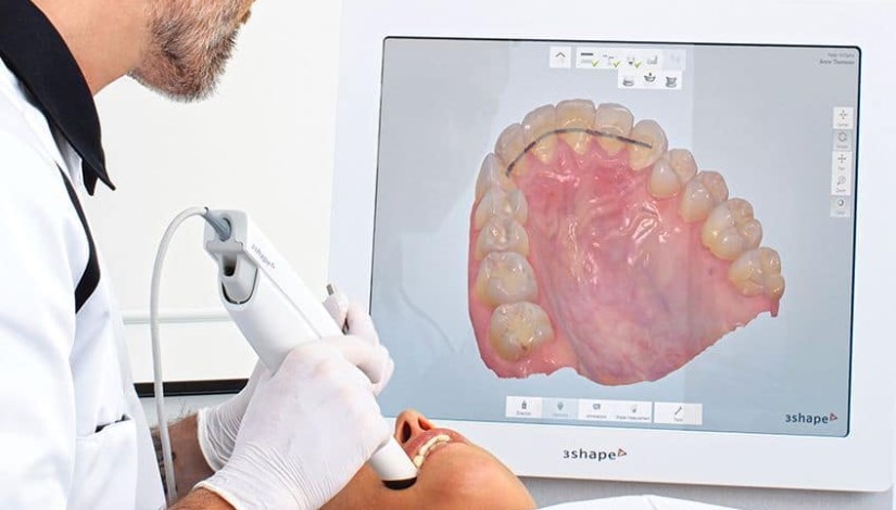 طب الأسنان الرقمي 