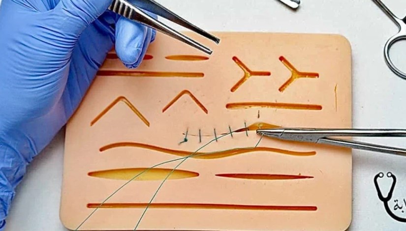  أشرطة الجراحة- أرشيفية